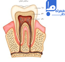 دندان درد 